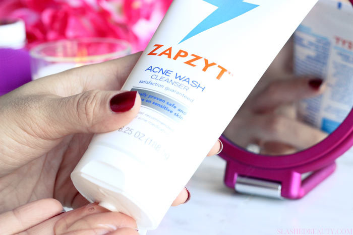 Find out why we get period acne-- why stubborn pimples appear and how to treat them -- I'm using ZAPZYT! | Slashed Beauty