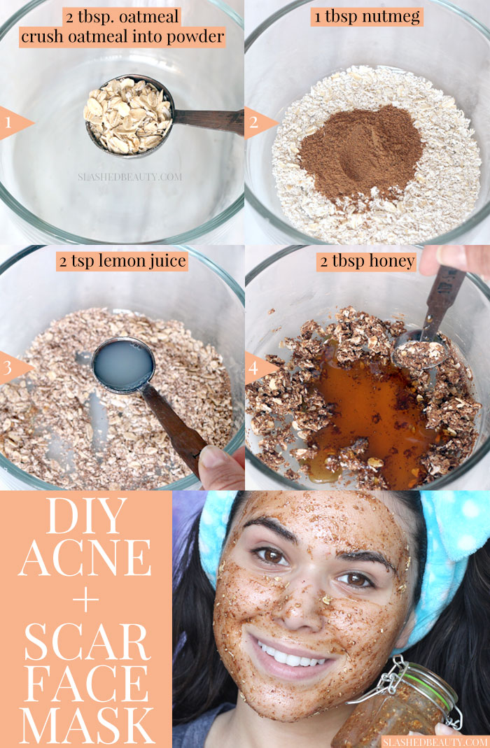 This DIY face mask for acne & scars uses honey and nutmeg to help clear pimples and lighten acne scars. It's easy to make with pantry ingredients!