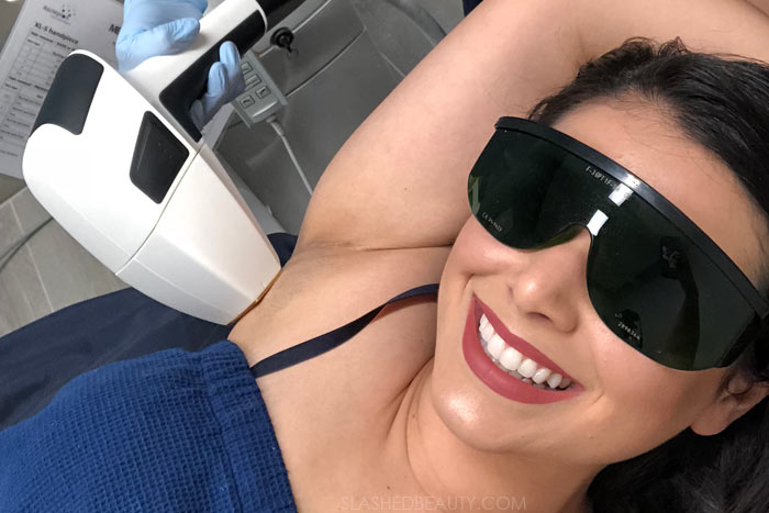 Laser Hair Removal Tips: What to Know Before You Start | Slashed Beauty