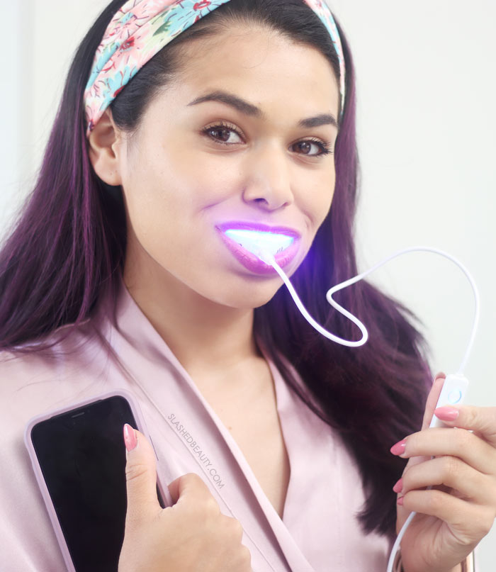 glowup. Review: Personalized At Home Teeth Whitening | Slashed Beauty