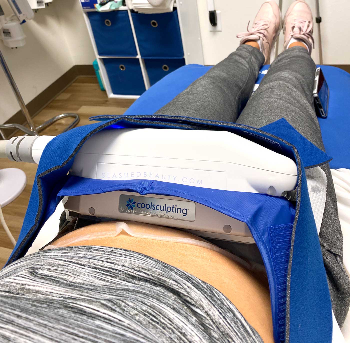 Coolsculpting the lower belly | Coolsculpting Before & After, How Much Does It Cost, How Long Does it Take? | Slashed Beauty