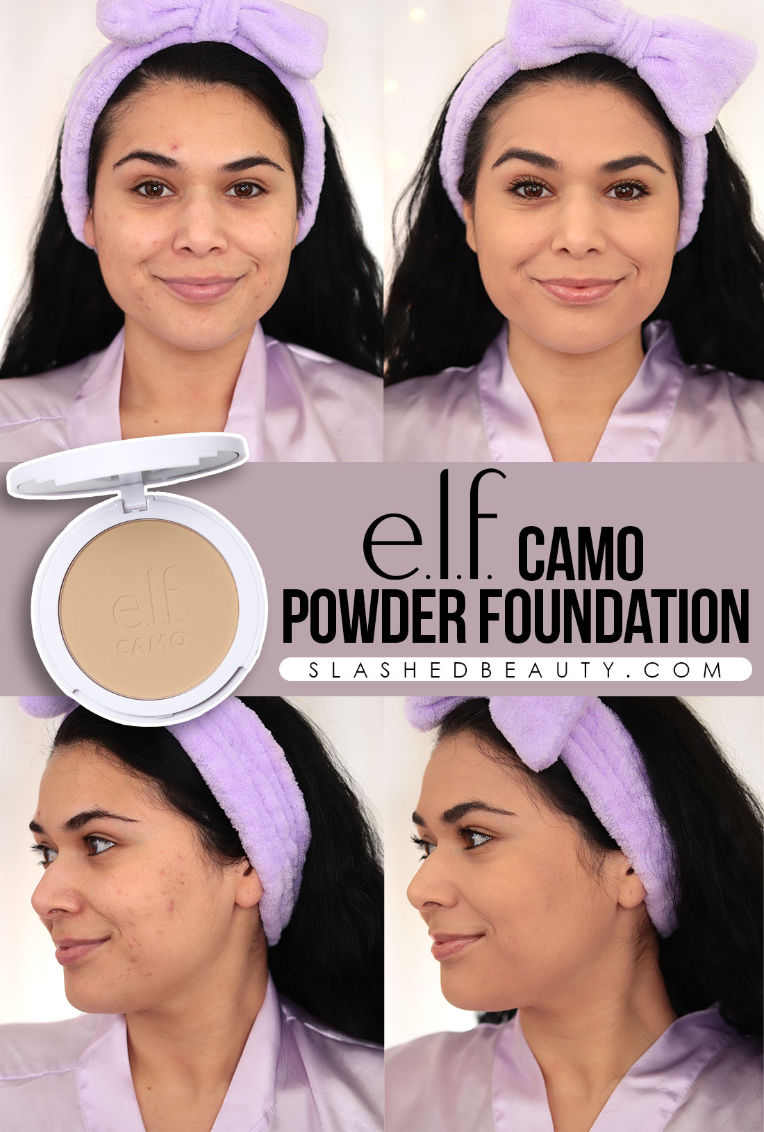 Before and after applying e.l.f. Camo Powder Foundation over acne, showing medium to full coverage | elf Camo Powder Foundation Review | Slashed Beauty