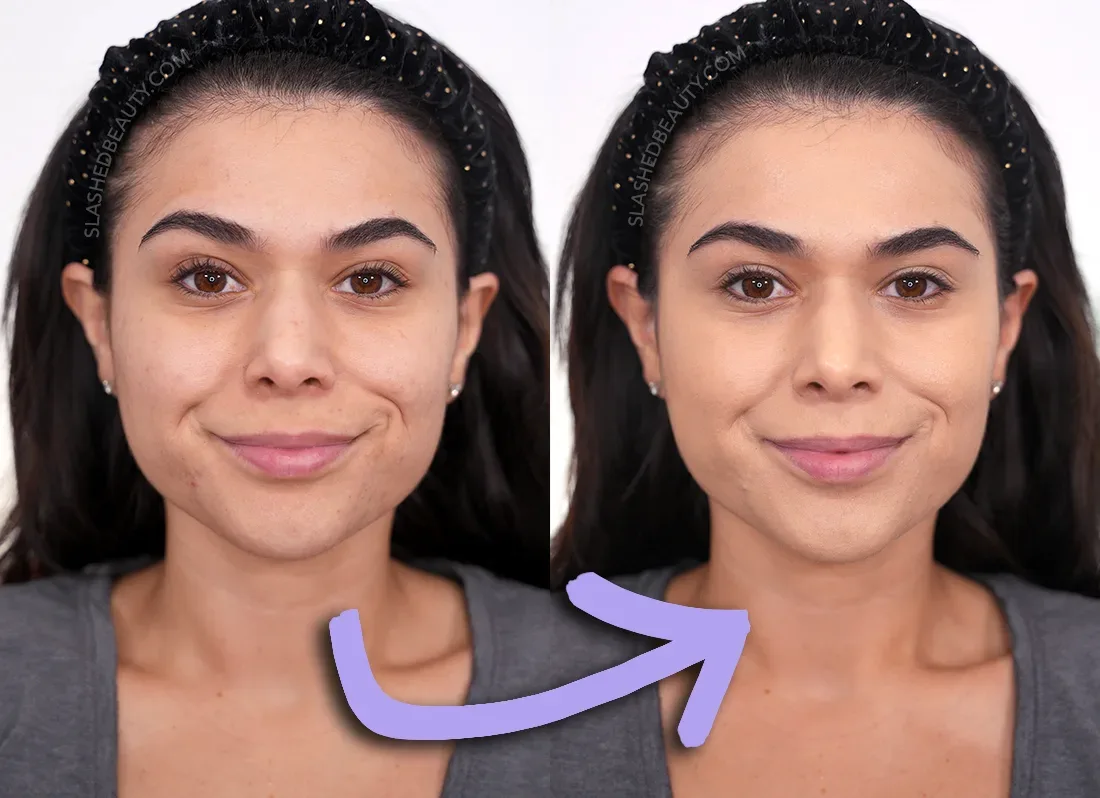 Side-by-side photos showing before and after applying the about-face Performer Skin Focused Foundation. Medium coverage is achieved, evening out redness and dark spots. | about-face Foundation Review | Slashed Beauty